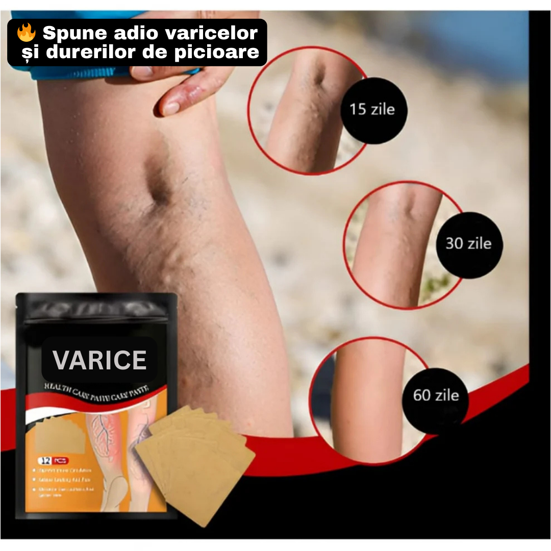 Plasturi pentru Varice & Dureri de Picioare™